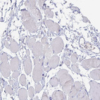 Anti-CFAP69 Antibody