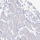 Immunohistochemical staining of human skeletal muscle shows no membranous positivity in myocytes as expected.