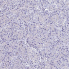 Anti-CFAP69 Antibody