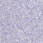 Immunohistochemical staining of human pancreas shows no membranous positivity in exocrine glandular cells.
