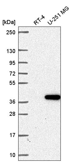 Anti-ZNF713 Antibody