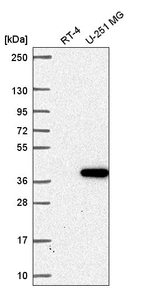 Anti-ZNF713 Antibody