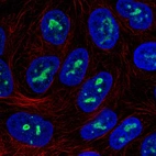 Immunofluorescent staining of human cell line RT4 shows localization to nucleoli.