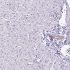 Anti-GPBAR1 Antibody