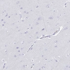 Immunohistochemical staining of human cerebral cortex shows no positivity in neurons as expected.