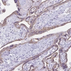 Immunohistochemical staining of human placenta shows moderate membranous positivity in trophoblastic cells.