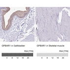 Immunohistochemistry analysis in human gallbladder and skeletal muscle tissues using HPA062890 antibody. Corresponding GPBAR1 RNA-seq data are presented for the same tissues.