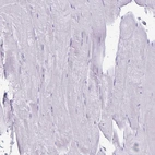 Immunohistochemical staining of human skeletal muscle shows no positivity in myocytes as expected.
