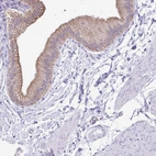 Immunohistochemical staining of human gallbladder shows moderate membranous positivity in glandular cells.