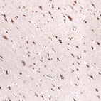 Anti-SMARCB1 Antibody