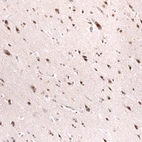 Immunohistochemical staining of human cerebral cortex shows strong nuclear-cytoplasmic positivity in neurons.