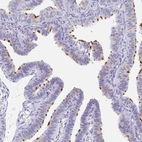 Immunohistochemical staining of human fallopian tube shows high expression.
