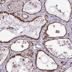 Immunohistochemical staining of human thyroid gland shows high expression.
