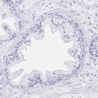 Immunohistochemical staining of human prostate shows low expression as expected.