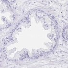 Immunohistochemical staining of human prostate shows low expression as expected.