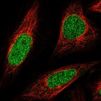 Anti-ABCA5 Antibody