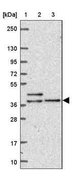 Lane 1: Marker [kDa] 250, 130, 95, 72, 55, 36, 28, 17, 10_br/_Lane 2: Human cell line RT-4_br/_Lane 3: Human cell line U-251 MG