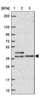 Lane 1: Marker [kDa] 250, 130, 95, 72, 55, 36, 28, 17, 10_br/_Lane 2: Human cell line RT-4_br/_Lane 3: Human cell line U-251 MG
