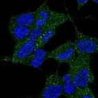 Immunofluorescent staining of human cell line SH-SY5Y shows localization to cytosol.