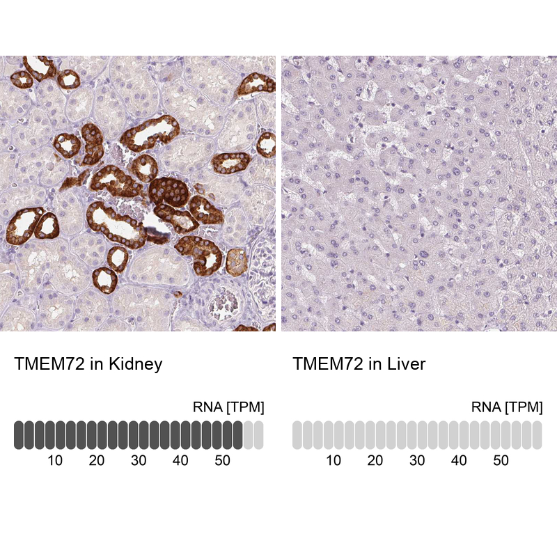 Anti-TMEM72 Antibody