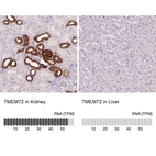 Anti-TMEM72 Antibody