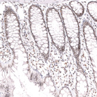 Anti-SMARCB1 Antibody