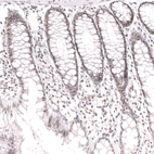 Immunohistochemical staining of human rectum shows moderate nuclear positivity in glandular cells and lymphoid cells.
