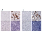 Immunohistochemical staining of human cerebral cortex, kidney, liver and lymph node using Anti-TMEM72 antibody HPA062907 (A) shows similar protein distribution across tissues to independent antibody HPA039894 (B).
