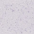 Immunohistochemical staining of human Cerebral cortex shows no positivity in neurons as expected.