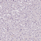 Anti-TMEM72 Antibody