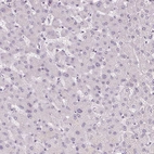 Immunohistochemical staining of human Liver shows no positivity in hepatocytes as expected.