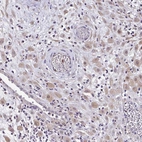 Anti-ZFP1 Antibody
