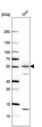 Western blot analysis in human skin tissue.