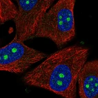 Immunofluorescent staining of human cell line SK-MEL-30 shows localization to nucleoli.