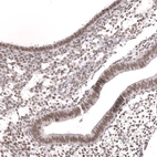Immunohistochemical staining of human endometrium shows moderate nuclear positivity in glandular cells and endometrium stromal cells.