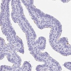 Immunohistochemical staining of human fallopian tube shows high expression.