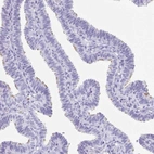 Immunohistochemical staining of human fallopian tube shows high expression.