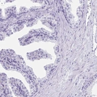 Immunohistochemical staining of human prostate shows low expression as expected.