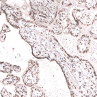 Anti-SMARCB1 Antibody