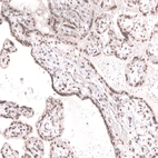 Immunohistochemical staining of human placenta shows moderate nuclear positivity in trophoblastic cells.
