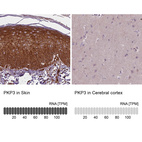 Anti-PKP3 Antibody