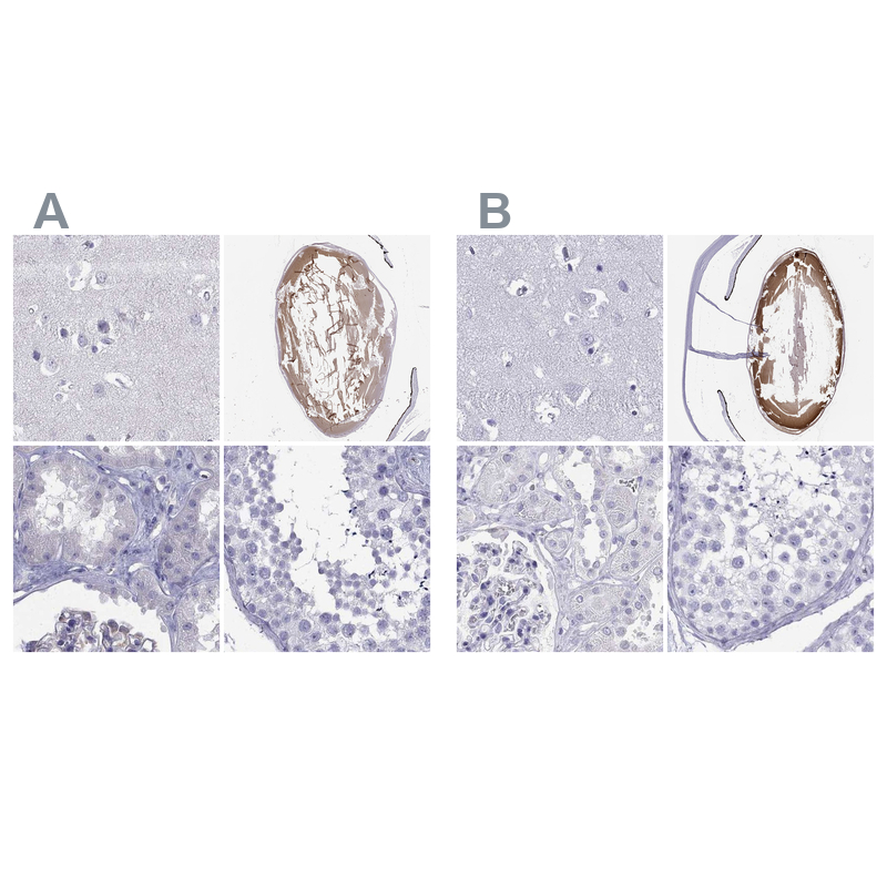 Anti-GJA8 Antibody