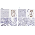 Anti-GJA8 Antibody