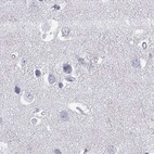 Immunohistochemical staining of human cerebral cortex using Anti-GJA8 antibody HPA062940.