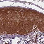 Immunohistochemical staining of human skin shows high expression.