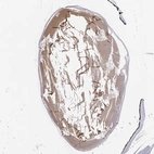 Immunohistochemical staining of human eye using Anti-GJA8 antibody HPA062940.