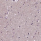 Immunohistochemical staining of human cerebral cortex shows low expression as expected.