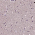 Immunohistochemical staining of human cerebral cortex shows low expression as expected.