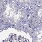 Immunohistochemical staining of human kidney using Anti-GJA8 antibody HPA062940.