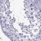 Immunohistochemical staining of human testis using Anti-GJA8 antibody HPA062940.
